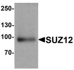 SUZ12 Antibody in Western Blot (WB)
