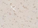 FMRP Polyclonal Antibody