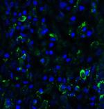 SMURF2 Polyclonal Antibody
