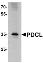 PHLP Polyclonal Antibody