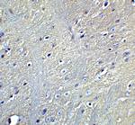 GABARAPL2 Antibody in Immunohistochemistry (Paraffin) (IHC (P))