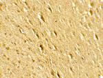 GABARAPL2 Antibody in Immunohistochemistry (Paraffin) (IHC (P))