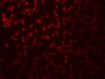 SAMHD1 Polyclonal Antibody