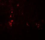 ATG4B Antibody in Immunohistochemistry (Paraffin) (IHC (P))