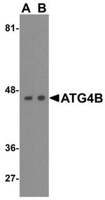 ATG4B Antibody in Western Blot (WB)
