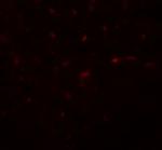 TRIB3 Antibody in Immunohistochemistry (Paraffin) (IHC (P))