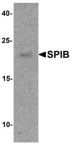 SPIB Antibody in Western Blot (WB)