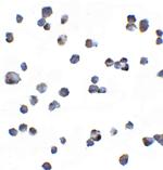 KIR2DS2 Antibody in Immunocytochemistry (ICC/IF)