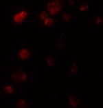 KIR2DS2 Antibody in Immunocytochemistry (ICC/IF)