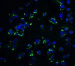 KIR2DS2 Polyclonal Antibody