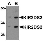 KIR2DS2 Antibody in Western Blot (WB)