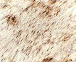 Golgin-97 Polyclonal Antibody