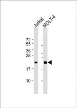 CD3z Polyclonal Antibody