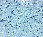 VTI1A Polyclonal Antibody