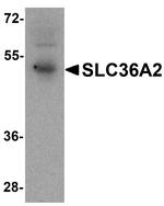 SLC36A2 Polyclonal Antibody