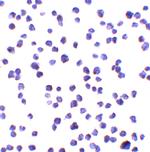 C9orf72 Polyclonal Antibody