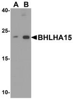 Mist1 Polyclonal Antibody