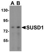 SUSD1 Polyclonal Antibody