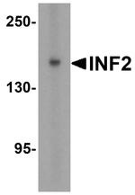 INF2 Polyclonal Antibody