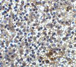 TIM-3 Antibody in Immunohistochemistry (Paraffin) (IHC (P))