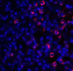 CD28 Antibody in Immunohistochemistry (IHC)