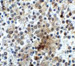 CD28 Antibody in Immunohistochemistry (IHC)