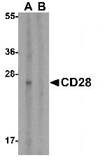 CD28 Antibody in Western Blot (WB)