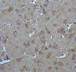 IRF7 Antibody in Immunohistochemistry (Paraffin) (IHC (P))