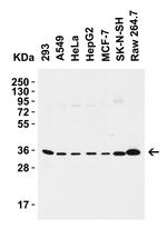 SIGLEC15 Polyclonal Antibody