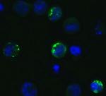 SARS-CoV-2 Spike Protein S1 Antibody in Immunocytochemistry (ICC/IF)