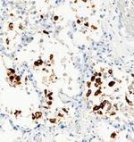 SARS-CoV-2 Spike Protein S1 Antibody in Immunohistochemistry (Paraffin) (IHC (P))