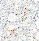 SARS-CoV-2 Spike Protein S1 Antibody in Immunohistochemistry (Paraffin) (IHC (P))
