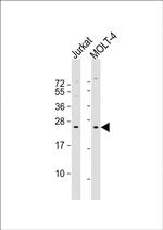 CD8 alpha Antibody in Western Blot (WB)