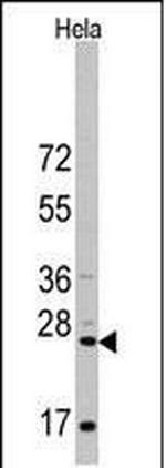CD8 alpha Antibody in Western Blot (WB)