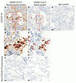 SARS-CoV-2 Nucleocapsid Antibody in Immunohistochemistry (IHC)