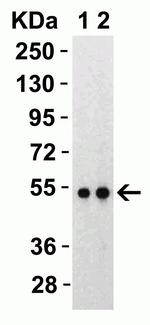 SARS-CoV-2 Nucleocapsid Antibody in Western Blot (WB)