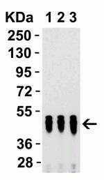 SARS-CoV-2 Nucleocapsid Antibody in Western Blot (WB)