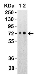 SARS-CoV-2 Spike Protein S2 Polyclonal Antibody
