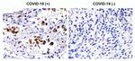SARS-CoV-2 Spike Protein S2 Polyclonal Antibody