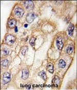 CD8 alpha Antibody in Immunohistochemistry (Paraffin) (IHC (P))