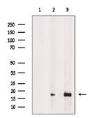 Phospho-4EBP1 (Thr37, Thr46) Antibody in Western Blot (WB)