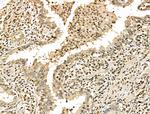Phospho-53BP1 (Ser25, Ser29) Polyclonal Antibody