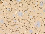 Phospho-53BP1 (Ser25, Ser29) Antibody in Immunohistochemistry (Paraffin) (IHC (P))