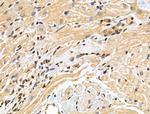 Phospho-53BP1 (Ser25, Ser29) Antibody in Immunohistochemistry (Paraffin) (IHC (P))