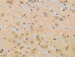 Phospho-53BP1 (Ser25, Ser29) Antibody in Immunohistochemistry (Paraffin) (IHC (P))