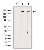 Phospho-53BP1 (Ser25, Ser29) Antibody in Western Blot (WB)