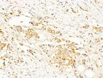Phospho-AMPK alpha-1,2 (Thr172) Antibody in Immunohistochemistry (Paraffin) (IHC (P))