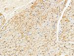 Phospho-AS160 (Ser588) Antibody in Immunohistochemistry (Paraffin) (IHC (P))