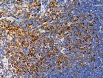 Phospho-AS160 (Ser588) Polyclonal Antibody