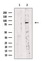 Phospho-beta Catenin (Tyr333) Antibody in Western Blot (WB)